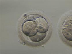 受精卵の写真